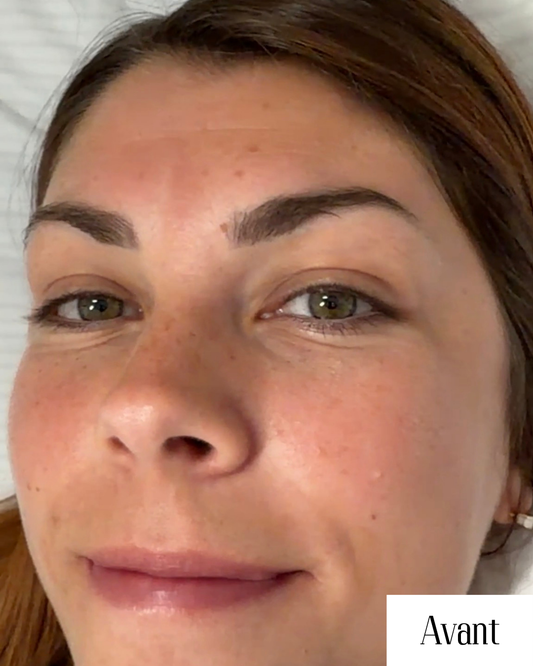 Lashlift Coréen